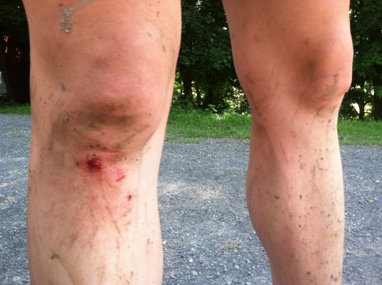 Not a real mountain bike ride unless there is blood.